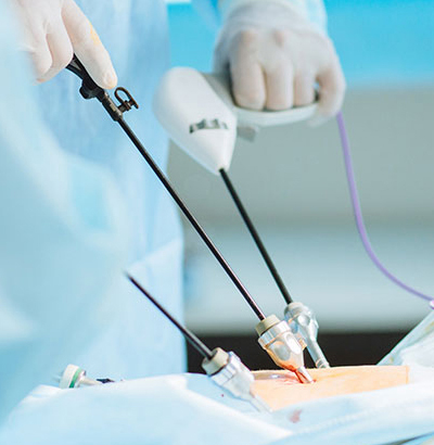 Laparoscopic and laser Surgery